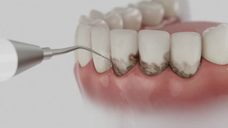Reliable Dental Implants contractor in Proctor, MN by Smile Center Dentistry